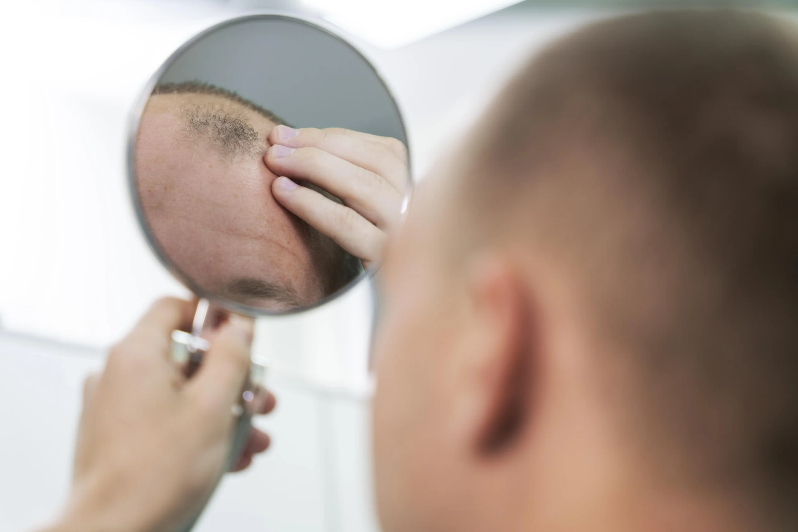 Como tratar queda de cabelo naturalmente